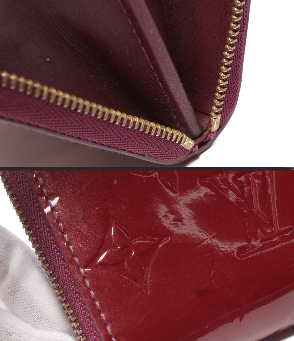ルイ・ヴィトン コインケース ジッピー コインパース ヴェルニ M93607 レディース LOUIS VUITTON